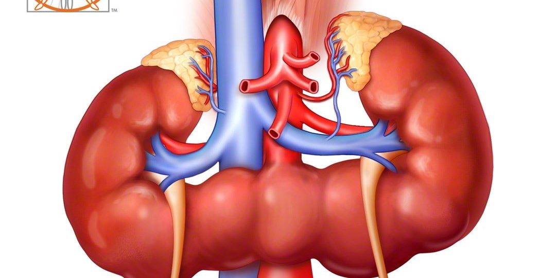 Horseshoe Kidney