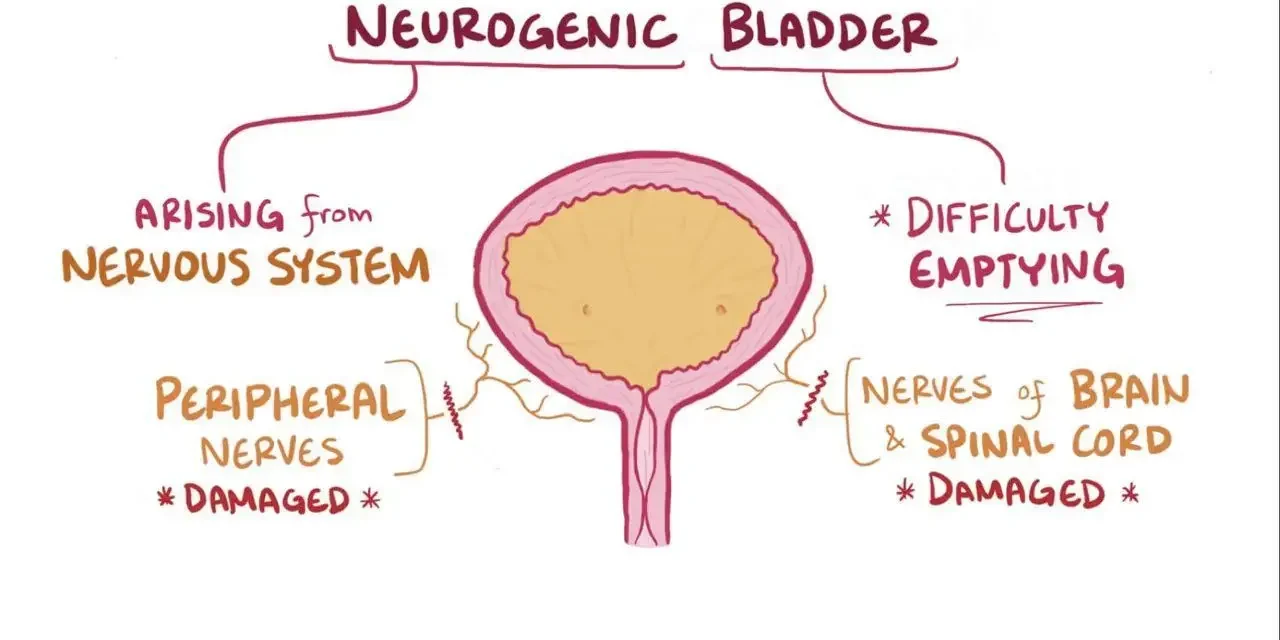 Neurogenic bladder