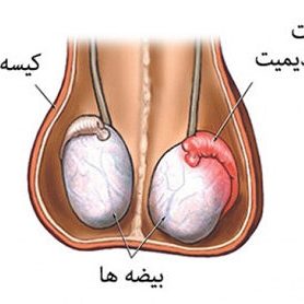 testicular